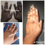 Dark Patches Eraser Cream - Image 6