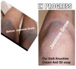 Dark Patches Eraser Cream - Image 5