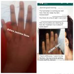 Dark Patches Eraser Cream - Image 2