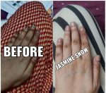 Dark Patches Eraser Cream - Image 4