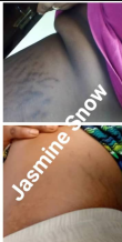 Stretch Marks Skin Repair Set - Image 2